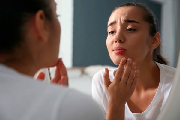 Опухшие губы